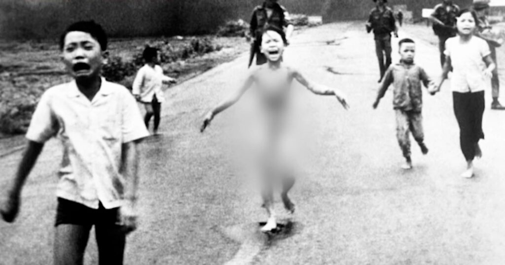 ‘Napalm girl’ in iconic Vietnam war photo gets final skin treatment 50 years later in US